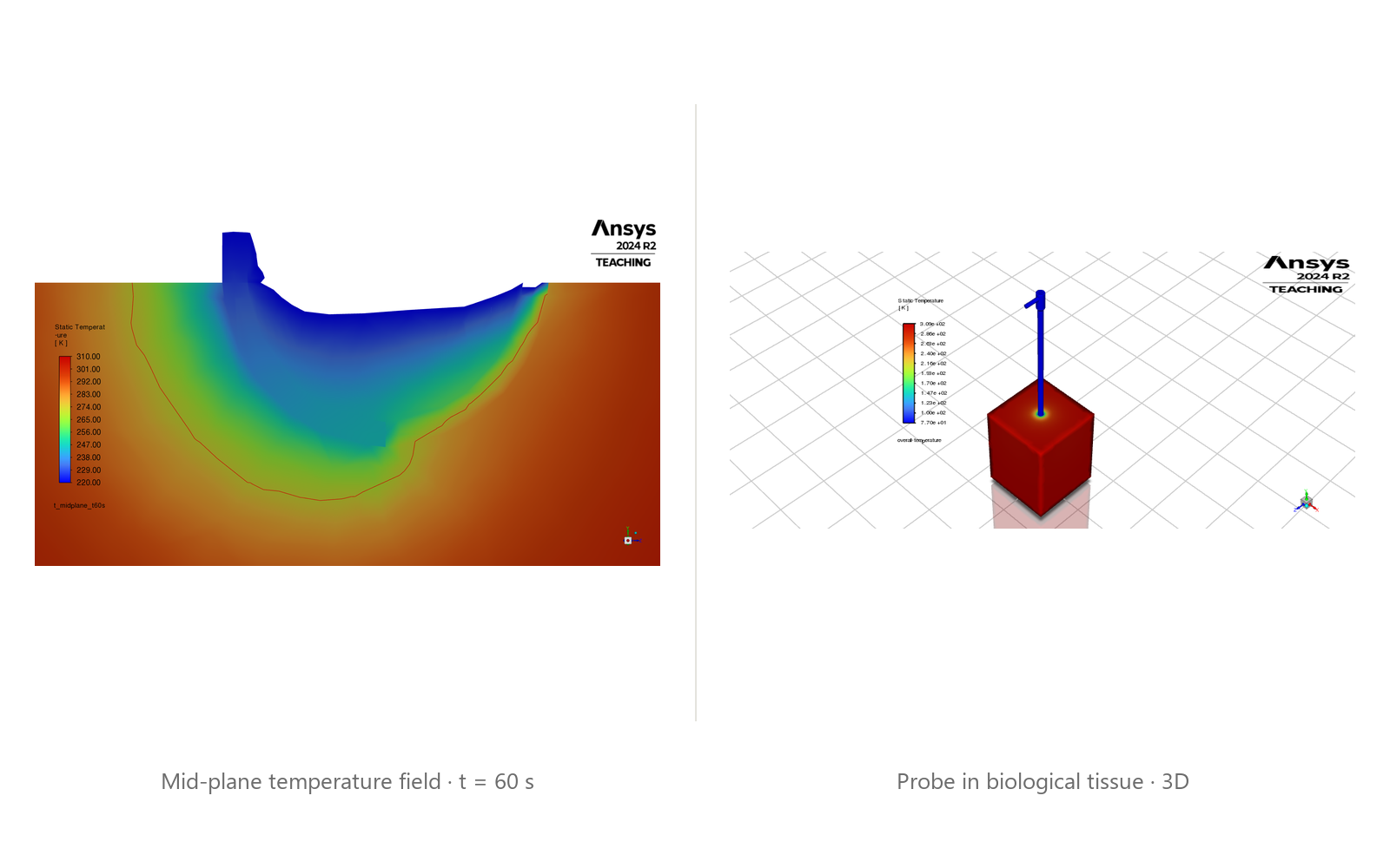 Cryoprobe ice-ball simulation